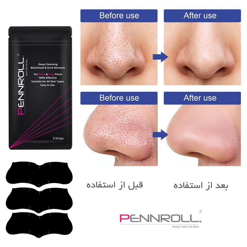 چسب پاک کننده بینی پنرول مدل PRD - Deep Blackhead Acne مجموعه 9 عددی