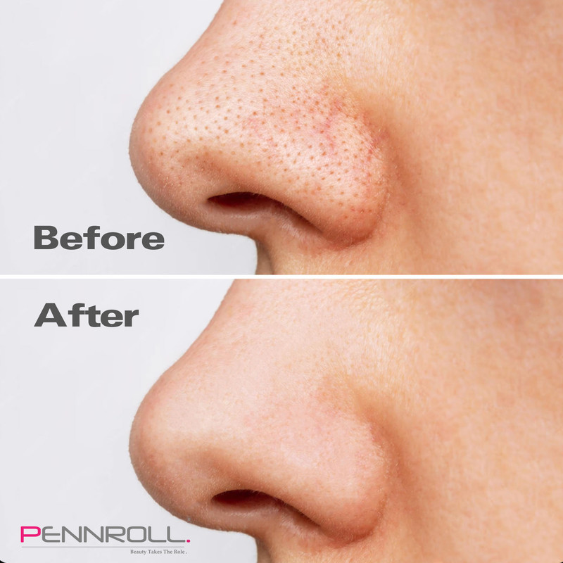چسب پاک کننده بینی پنرول مدل PRD - Deep Blackhead Acne مجموعه 9 عددی