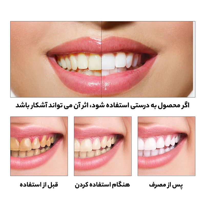 محلول سفید کننده دندان لنبنا مدل اسنس حجم 10 میلی لیتر