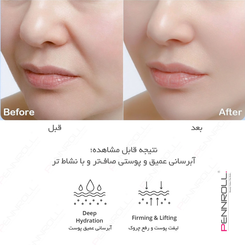 ماسک ژلی صورت و بدن پنرول مدل PRD با وزن 30 گرم، آبرسان عمیق، ضد چروک، لیفت کننده، کوچک کننده منافذ، روشنکننده، مرطوبکننده و ترمیمکننده، حاوی هیالورونیک اسید و ویتامین B3، مناسب انواع پوست، با رایحه گل