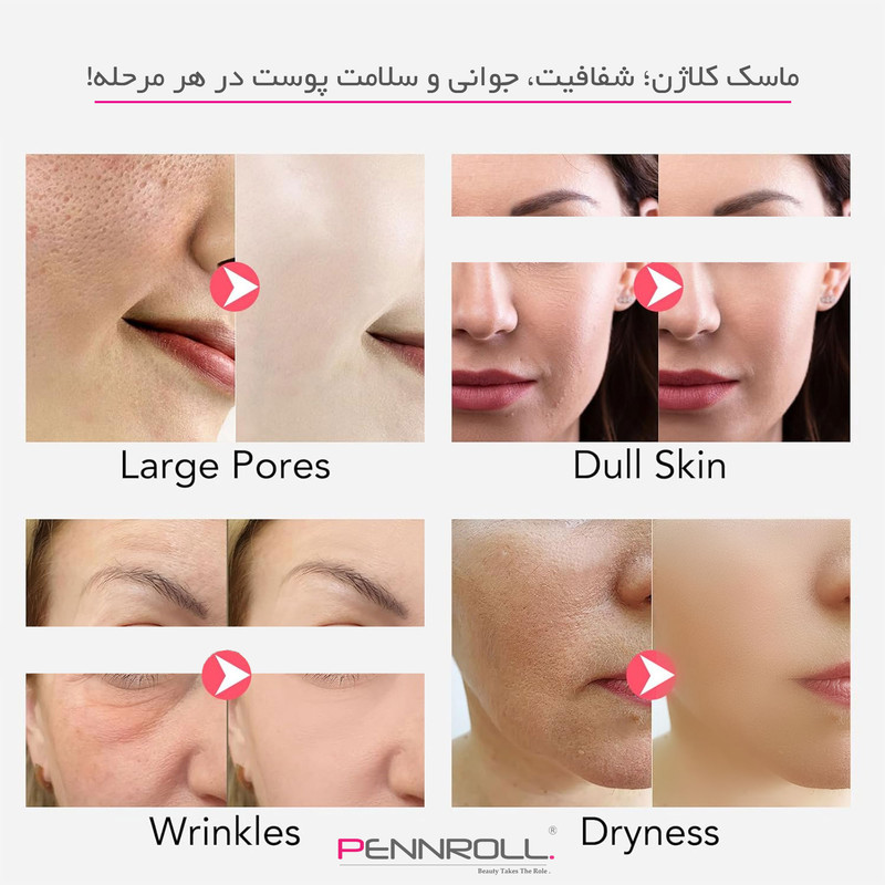 ماسک ژلی صورت و بدن پنرول مدل PRD با وزن 30 گرم، آبرسان عمیق، ضد چروک، لیفت کننده، کوچک کننده منافذ، روشنکننده، مرطوبکننده و ترمیمکننده، حاوی هیالورونیک اسید و ویتامین B3، مناسب انواع پوست، با رایحه گل