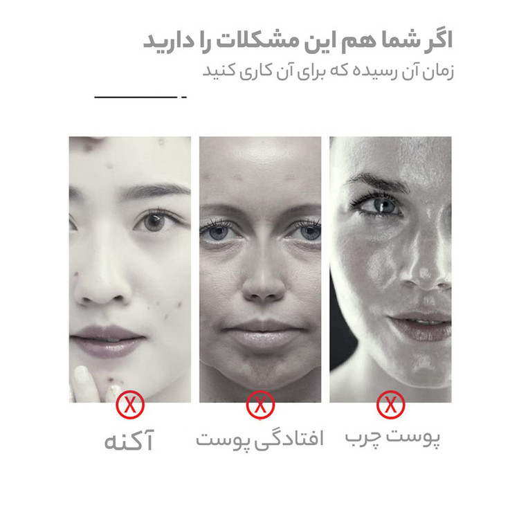 ماسک صورت بایو آکوا کد 1 وزن 25 گرم بسته 4 عددی