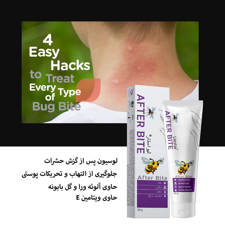 لوسیون پس از گزش حشرات بدن لیواستار مدل برگ ریحان مناسب برای انواع پوست وزن 30 گرم