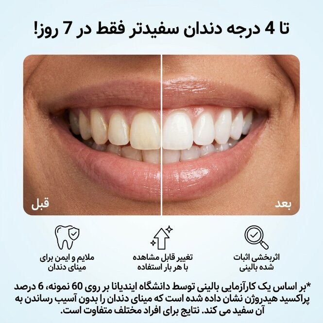 نوار سفیدکننده دندان آی وی اسمایل مدل HP بسته 7 عددی
