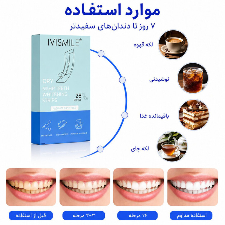 نوار سفیدکننده دندان آی وی اسمایل مدل HP بسته 7 عددی